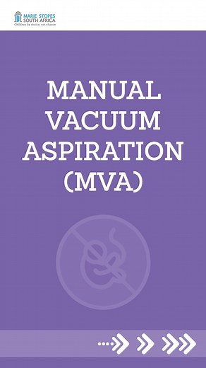 Surgical Abortion 101: What is an MVA (Manual Vacuum Aspiration)? Marie Stopes South Africa has all the information you need! Got questions? Ask away, or call 0800 11 77 85. We're here for you💙 #abortion #safeabortion #surgicalabortion | Marie Stopes South Africa