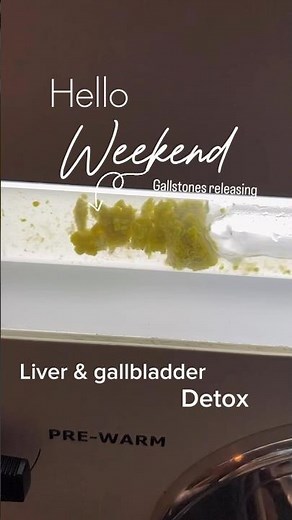 Gallstones flush - liver gallbladder flush, liver gallbladder cleanse