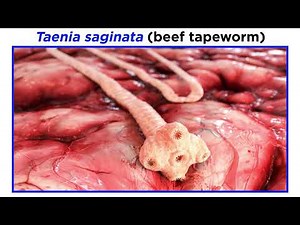 Phylum Platyhelminthes Part 4: Tapeworms of Class Cestoda