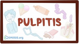 Pulpitis: Video, Causes, & Meaning | Osmosis