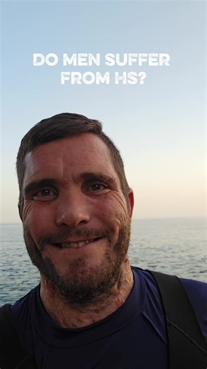 Hidradenitis Suppurativa en Hombres: Un Desafío Silencioso