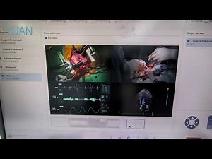 AI-Driven Digital Operating Room Solution