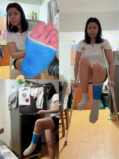 Real injury SLC · hopping & limping · home routine NOW AVAILABLE IN OUR WEBSITE: https://mrcrutchingaround.sellfy.store/p/by-hiraya/ #sockcast #bandagedfoot #sprained #brokenleg #brokenfoot #crippled #legcast