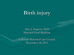 Birth injury - SlideServe