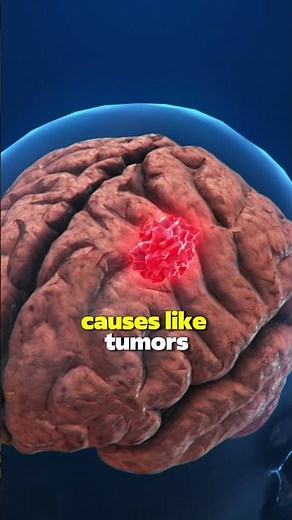 What spinal cord injury is and how it affects the body