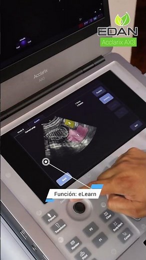 ULTRASONIDO EDAN AX3! Con la función eLearn, tendrás acceso a tutoriales prácticos y específicos