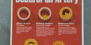 Berkeley County Library and SCDPH partner for heart disease prevention event