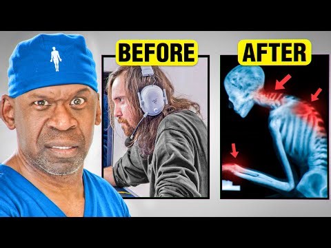 Gaming is Killing You Slowly IRL…Here’s Why | Surgeon Explains Gaming and E-Sports Injuries