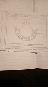 Study the diagram representing a section through an alveolus an... | Filo