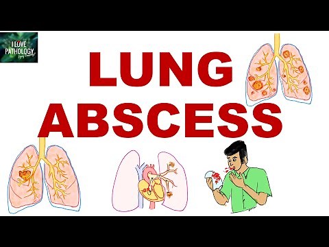 Lung abscess |etiopathogenesis |Morphology |clinical features| complications