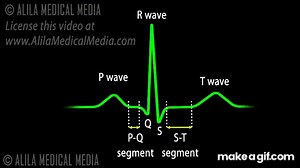 Cardiac Conduction System and Understanding ECG, Animation. on Make a GIF