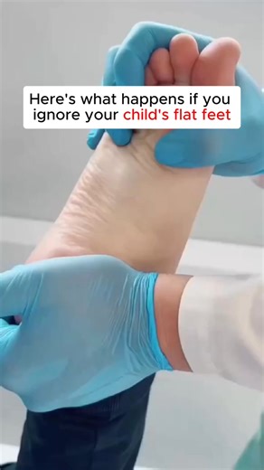 Your child's foot pain isn't just 'growing pains' - and ignoring it could lead to permanent problems. While you wait 14 months for NHS treatment, improper foot alignment is affecting your child's knees, hips, and back development. The longer you wait, the harder it becomes to correct. What starts as heel pain after football can become chronic joint problems that follow them into adulthood. Don't let another term pass watching your child limp home from school. Footstr insoles provide the professi