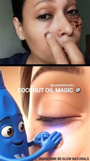 1 Coconut Oil = 3 Beauty Problems Solved 😍 | Blackheads • Dark Circles • Hair Growth
