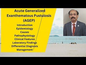 Acute Generalized Exanthematous Pustulosis (AGEP)