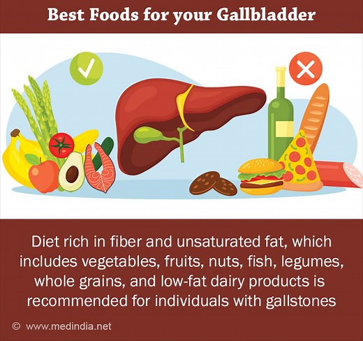 Gallstone Diet: Foods to Eat and Foods to Avoid