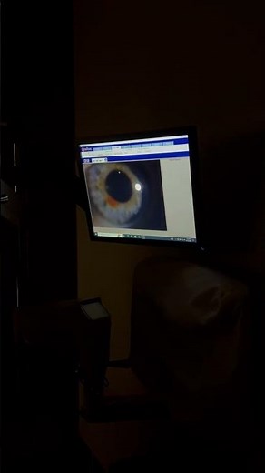 Using the realtime slit lamps for the first time
