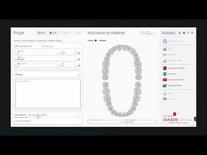 Export commande 3Shape et import Exocad 3.2 Elefsina