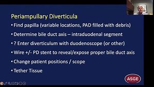 DDW 2023 Highlights: Advanced Cannulation Techniques
