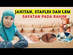 metode jahitan pada rahim dan jenis jahitan kulit operasi Caesar