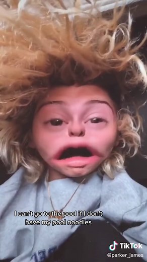 Where Are My Pool Noodles?