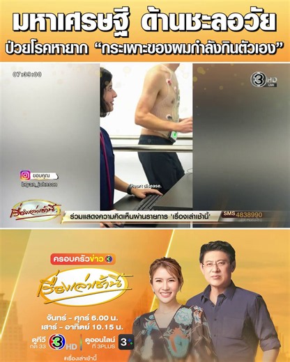 #เรื่องเล่าเช้านี้ สะเทือนวงการสุขภาพ “ไบรอัน จอห์นสัน” มหาเศรษฐีด้านชะลอวัย เจ้าของคอนเซปต์ Don’t Die ทุ่ม 70 ล้าน ทำโปรเจคแฮกร่างกายให้เซลล์กลับมาเป็นเด็กอายุ 18 ล่าสุดโพสต์แจ้งข่าวป่วยโรคหายาก โรคแพ้ภูมิตัวเอง ภูมิคุ้มกันทำลายกระเพาะอาหาร เผย “กระเพาะของผมกำลังกินตัวเอง”#ข่าวช่อง3 #ไบรอันจอห์นสัน #มหาเศรษฐี #ชะลอวัย #แพ้ภูมิตัวเอง #กระเพาะอาหาร
