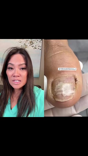 The Dangers of Excessive Nail Trimming - Avoid Onychorrhexis