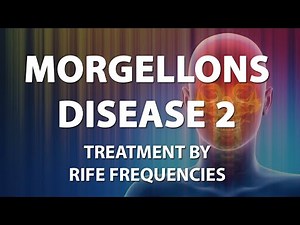 Morgellons Disease 2 - RIFE Frequencies Treatment - Energy & Quantum Medicine with Bioresonance