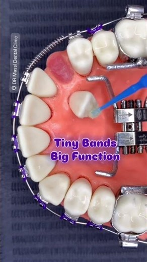 TINY BANDS BIG FUNCTION ⚒️😬