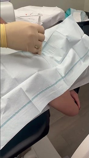 Cervical Spine injection C7, T1 area. It wasn’t bad at ALL, and Dr Schneider did wonderful(always).
