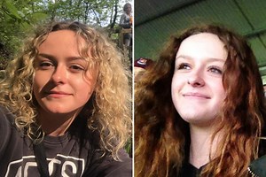 Woman, 21, has leg amputated after it was 'sliced off at knee' in crash