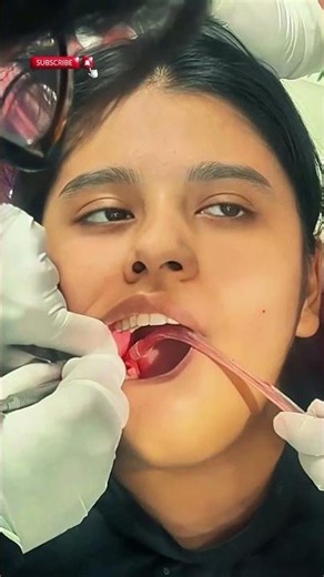 Wisdom Teeth Troubles? See How Dr. Vandana Thakran Removes It Without Pain