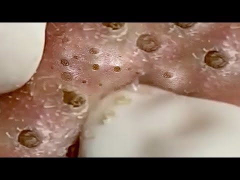 𝑨𝒄𝒉𝒊𝒆𝒗𝒆 𝑰𝒏𝒏𝒆𝒓 𝑷𝒆𝒂𝒄𝒆 𝑾𝒊𝒕𝒉 𝑻𝒉𝒆𝒔𝒆 𝑭𝒂𝒄𝒊𝒂𝒍 𝑪𝒍𝒆𝒂𝒏𝒔𝒊𝒏𝒈 𝑴𝒆𝒕𝒉𝒐𝒅𝒔 #𝟐𝟑𝟖𝟗𝟏