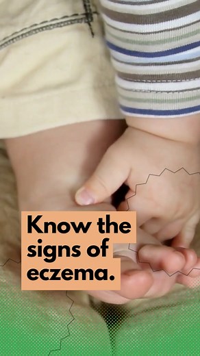 Is your child scratching nonstop or developing rashes that won’t go away? It might be more than simple irritation. Many kids experience eczema, a skin condition that needs the right care, triggers to avoid, and soothing routines. Learn how to tell if it’s eczema — and what you can do at home: 👉 https://myhealthychild.ph/what-if-my-child-is-always-scratching-or-has-skin-rashes/ | My Healthy Child