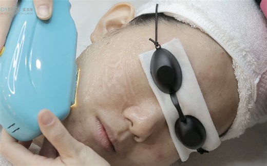 OPT光子美容仪操作手法教学