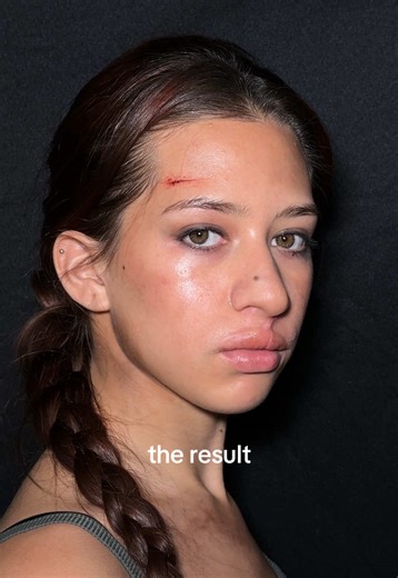 first silicone prosthetic I made and applied on @sofiavelourfx for my prosthetics class @Cinema Makeup School im so proud of this one! #prosthetics #cleftlip #sfxmua #specialeffects #fyp