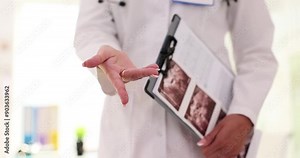 Doctor holds documents with ultrasound pictures and extends hand