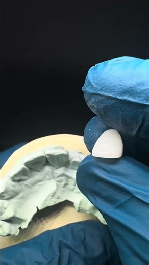 #emax #dentist #dentallaboratory #digitaldentistry #cadcam #ny #nj #dentalclinic