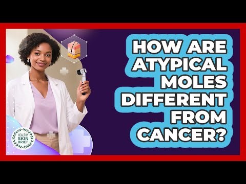How Are Atypical Moles Different From Cancer?
