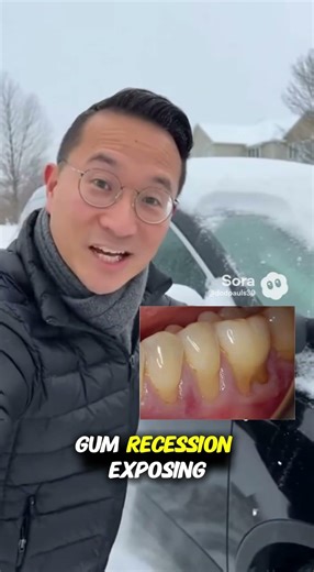 Why Cold Drinks Cause Sharp Tooth Pain #OralHealth #DentalCare #HealthySmile #DentalEducation