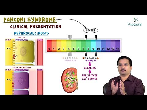 Fanconi syndrome - Etiology, Clinical Features, Pathology, Diagnosis and Treatment #usmle pathology