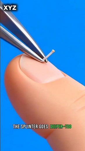 ​🤯 What Happens to a Splinter Deep Inside Your Body? (The Shocking Truth)