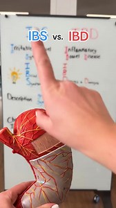 91K views · 1.7K reactions | PSA: IBS and IBD are NOT the same thing!  #nursingeducation #IBS #IBD #Crohns #colitis #nursingschool #nurseinthemaking | Nurse making | Facebook