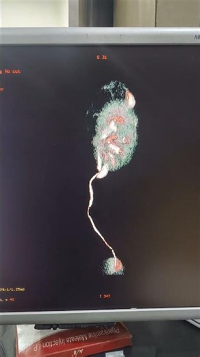 #viral #humananatomy #ctscan #viralshorts #anatomy