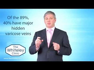 CEAP Classification - C1: Telangectasia (Thread veins / Spider veins / Broken veins)