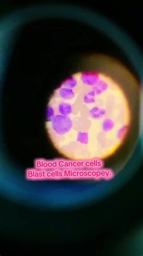 MLT Microscopey. (@mltmicroscopey)’s videos with original sound - USA ACCOUNT FOR SALE