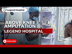 🩹 **Orthopedic Surgery Insight: Above-the-Knee Amputation** 🩹