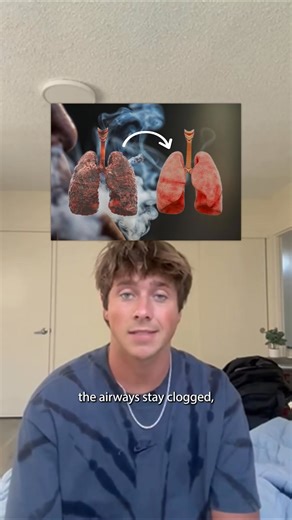 “I wasn’t ‘sick.’ I was just over the constant wheeze. Every check-up said my lungs looked fine, but I knew better — they weren’t clear. RespiClear finally helped me loosen the gunk and breathe free again. If mornings feel like a weight pressing on your chest, you’ll want to try this.” 🌿 Traditional herbs to clear & open your lungs 😌 Breathe easier, rest deeper, wake lighter ✨ Real relief without the side-eye or stigma | Organivie