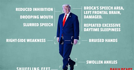 These Are the Physical and Mental Signs Trump Has Had a Stroke: Doctor