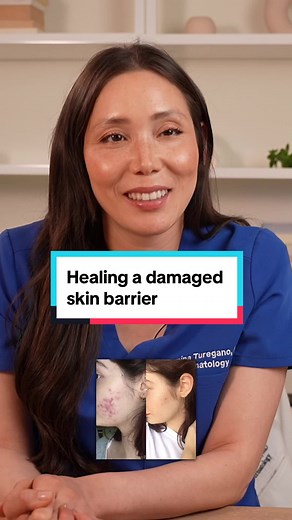 A damaged skin barrier can be healed quickly with these recommendations. TLDR: Keep things gentle! @La Roche-Posay @LaRochePosayUS @CeraVe @Eau Thermale Avène @AveneUSA @Cetaphil US @Neutrogena @AquaphorUS #skincare #skintok #skincareroutine #skincaretips #skinbarrier #damagedskinbarrier #skinbarrierrepair #healthyskin #derm #drmamina