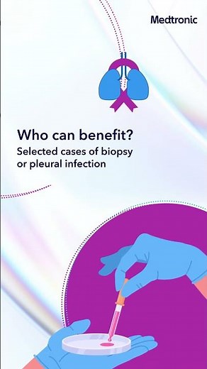 Breathe Better with VATS | Medtronic India
